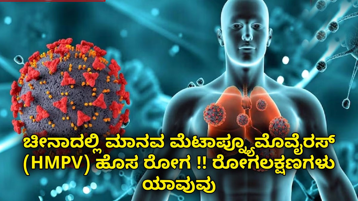 ಚೀನಾದಲ್ಲಿ ಮಾನವ ಮೆಟಾಪ್ನ್ಯೂಮೊವೈರಸ್ (HMPV) ಹೊಸ ರೋಗ !! ರೋಗಲಕ್ಷಣಗಳು ಯಾವುವು ಚೀನಾದಲ್ಲಿ ಮಾನವ ಮೆಟಾಪ್ನ್ಯೂಮೊವೈರಸ್ (HMPV) ಹೊಸ ರೋಗ !! ರೋಗಲಕ್ಷಣಗಳು ಯಾವುವು