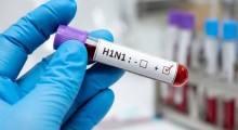Swine Flu Cases Rise in Delhi: 134 New H1N1 Infections Reported in 24 Hours