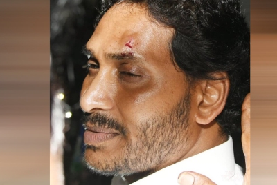 Andhra Pradesh CM Jagan Mohan Reddy Encountered A Stone Attack In Vijayawada